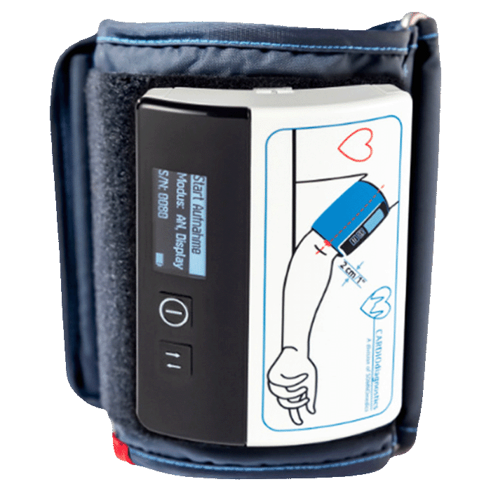 Ambulatory Blood Pressure Monitoring